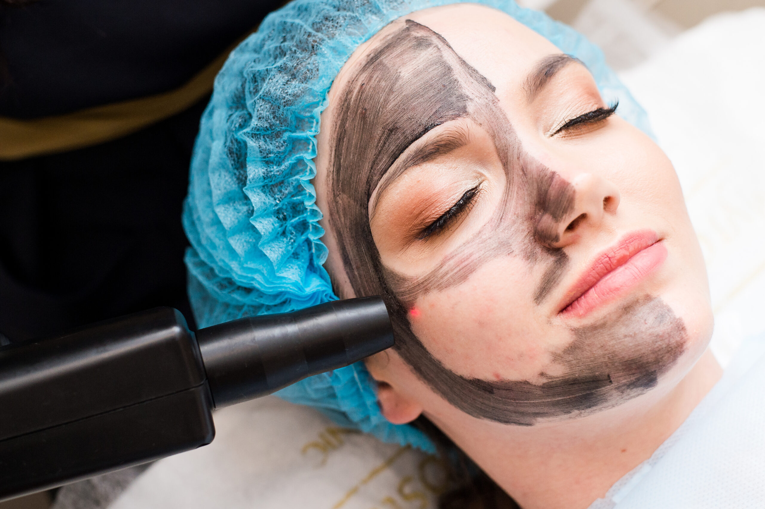 Пілінги обличчя