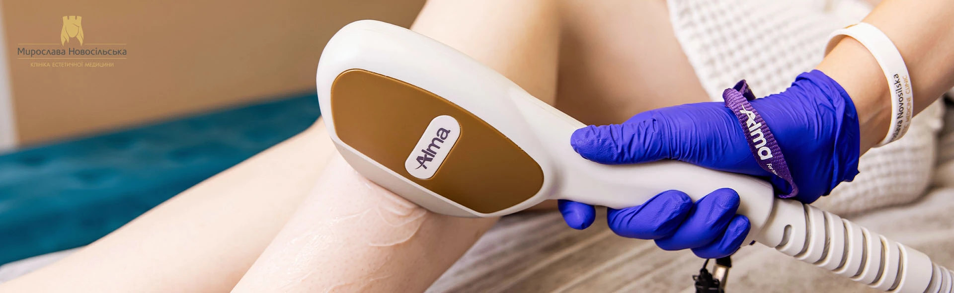 Laser epilation of the whole body, photo 1