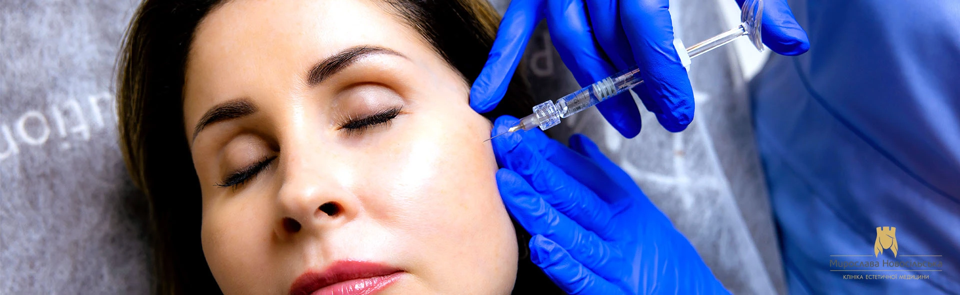 Fillers in nasolabial folds, photo 1