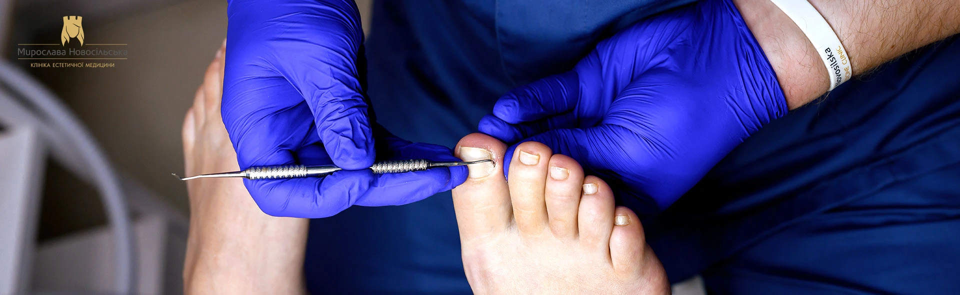 Treatment of hyperkeratosis, photo 1