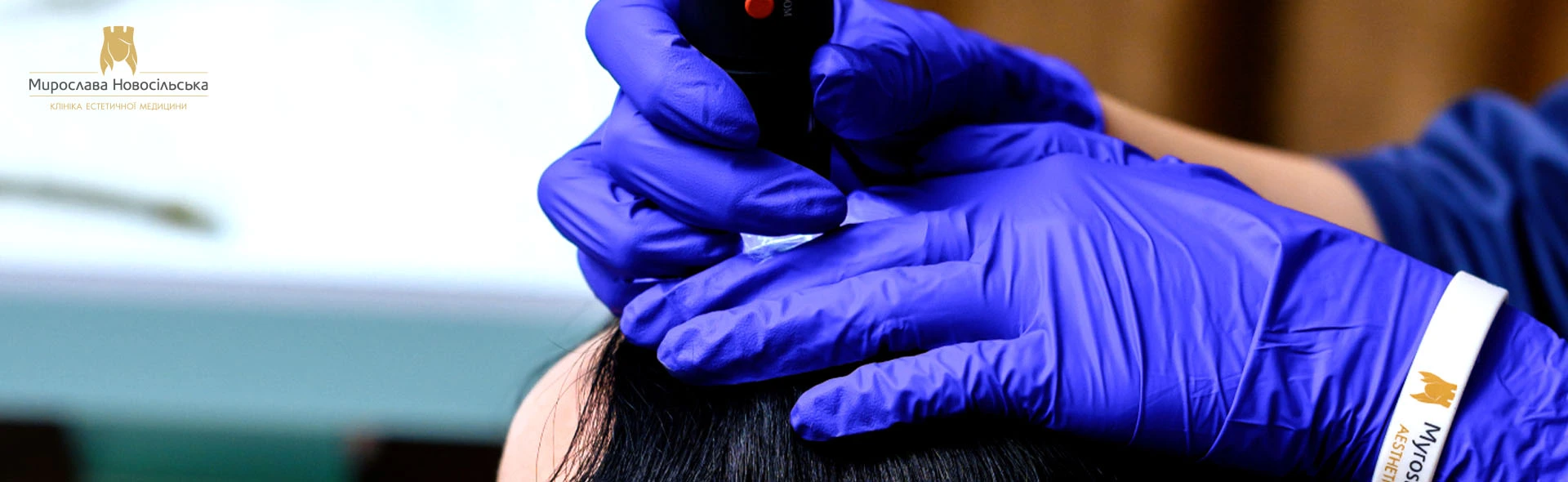 Treatment of alopecia in women, photo 1