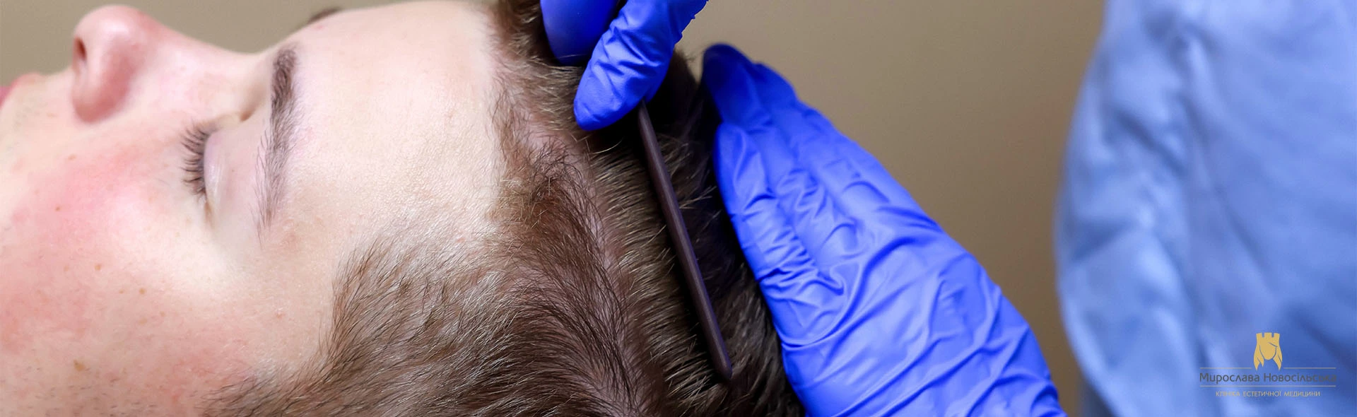 Eyebrow transplant, photo 1