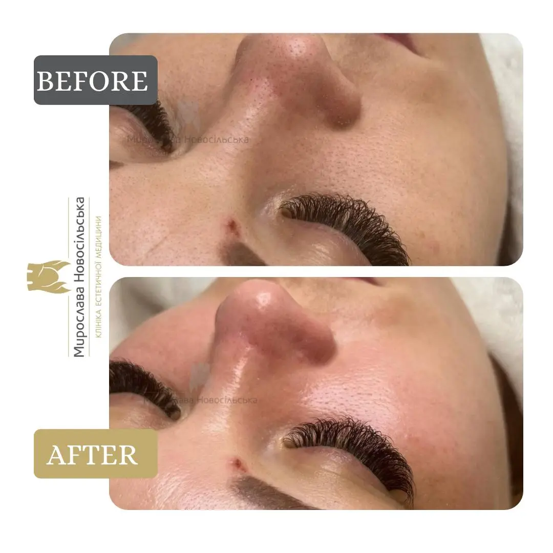 Facial cleansing, photo 7