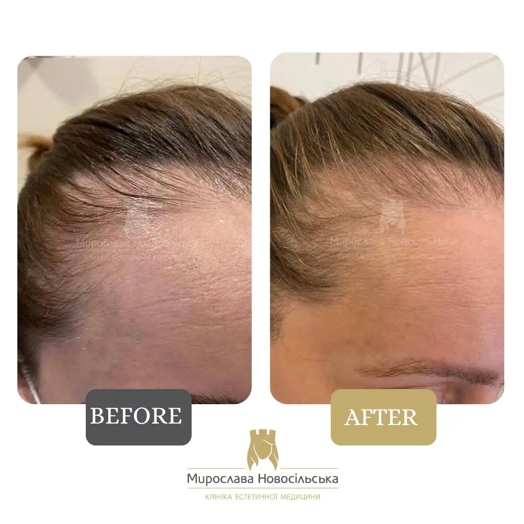Treatment of alopecia in women, photo 6