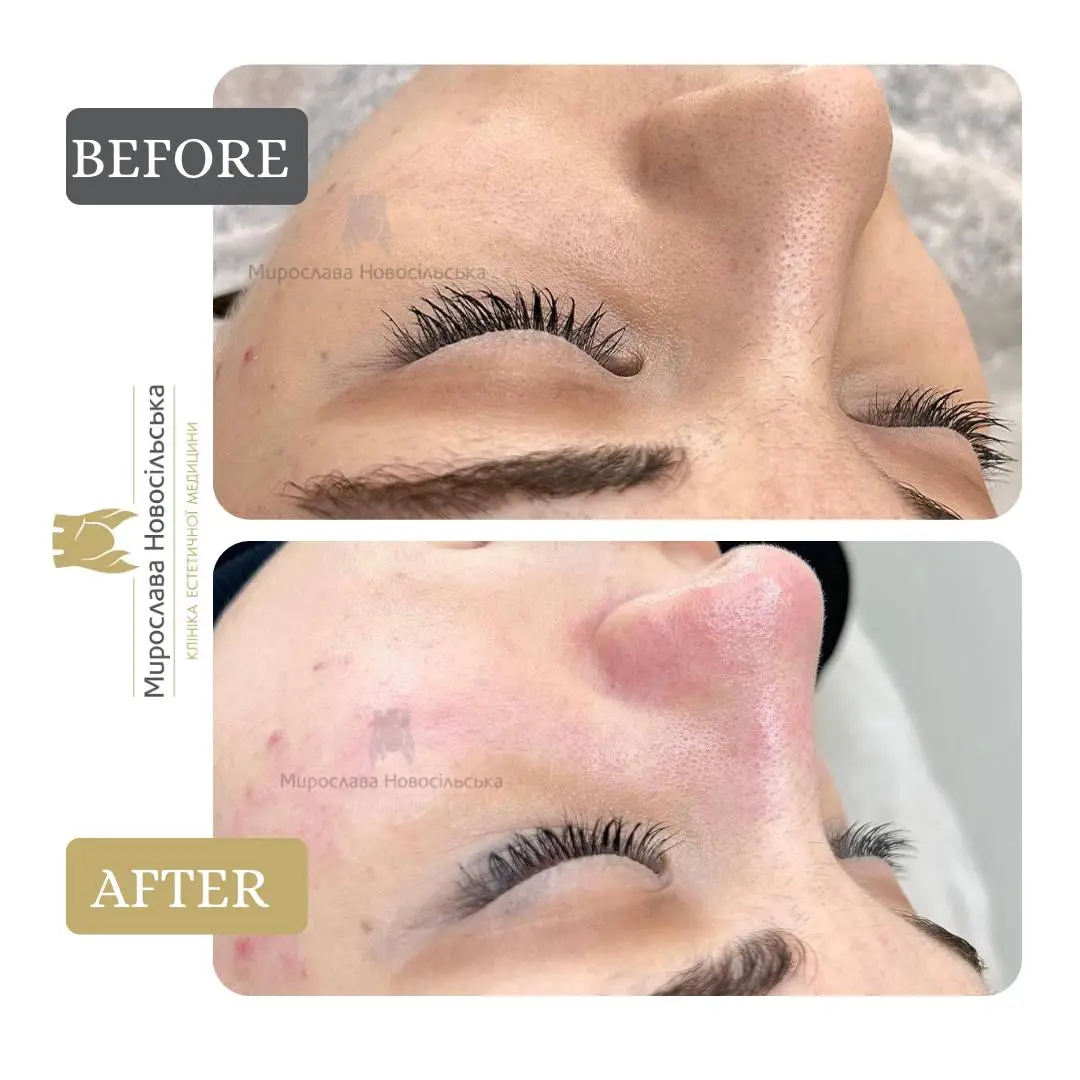 Facial cleansing, photo 6