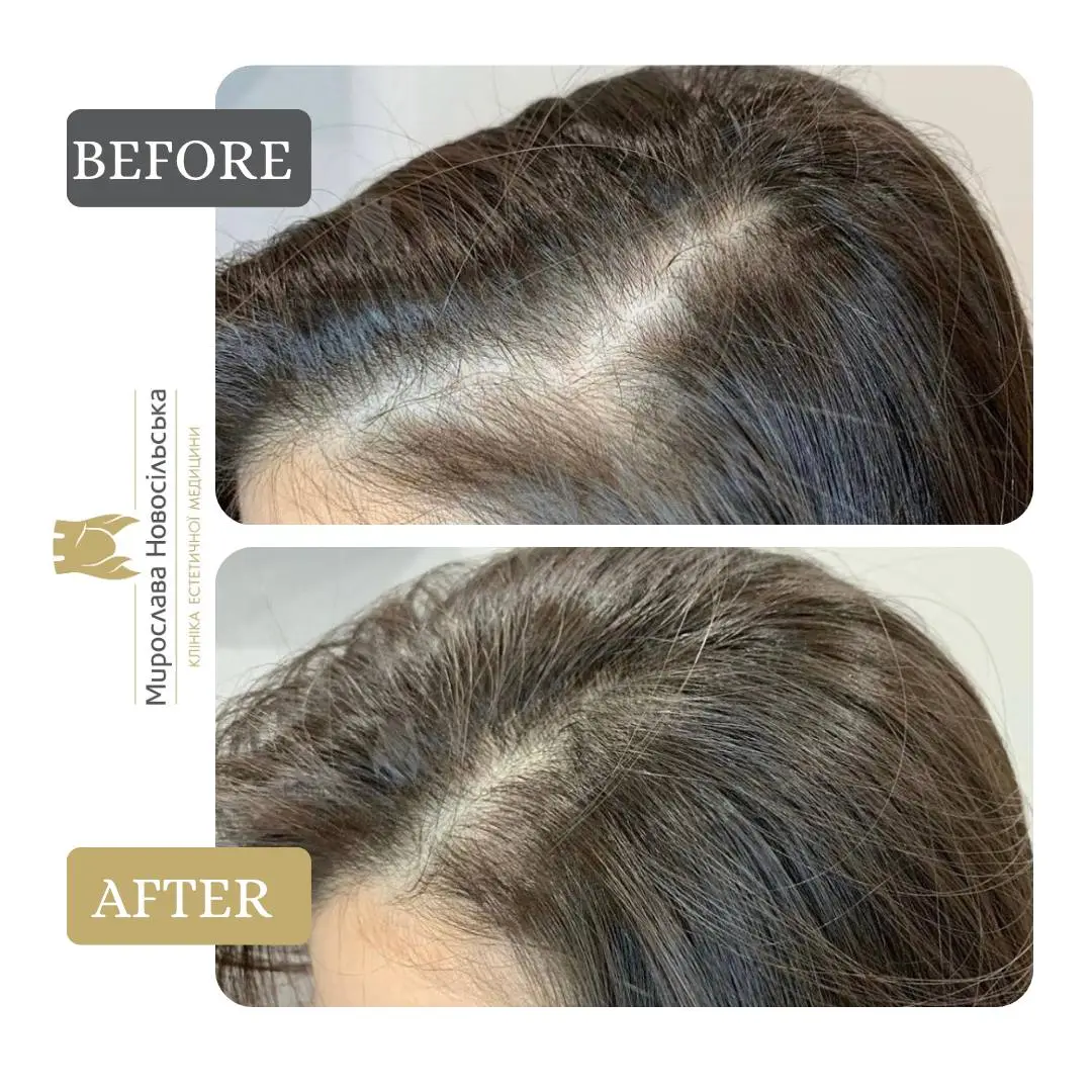 Hair procedures, photo 2