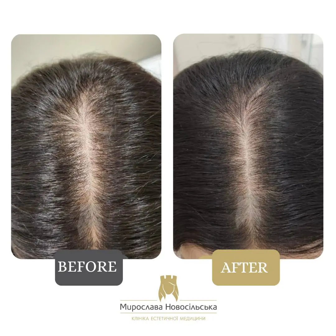 Hair procedures, photo 3