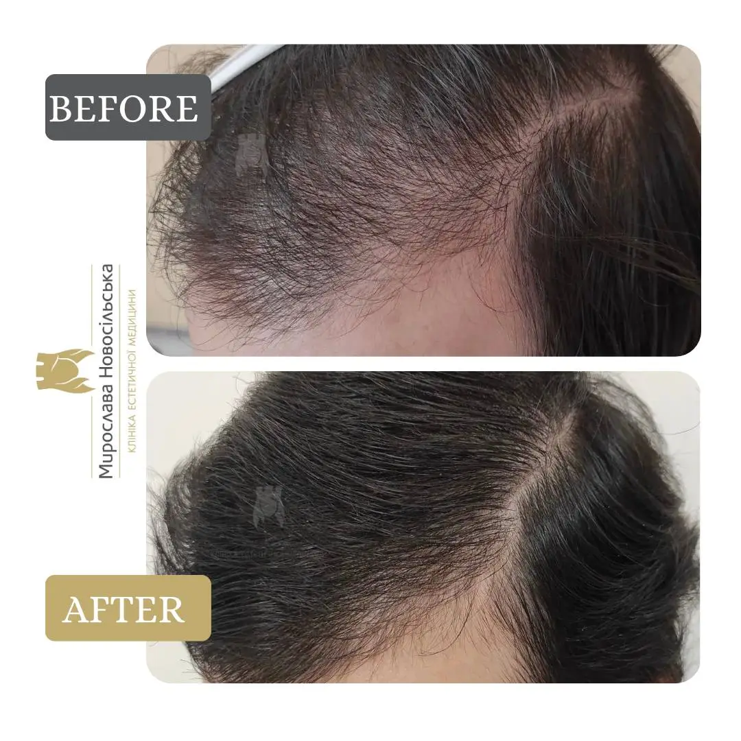 Hair procedures, photo 4