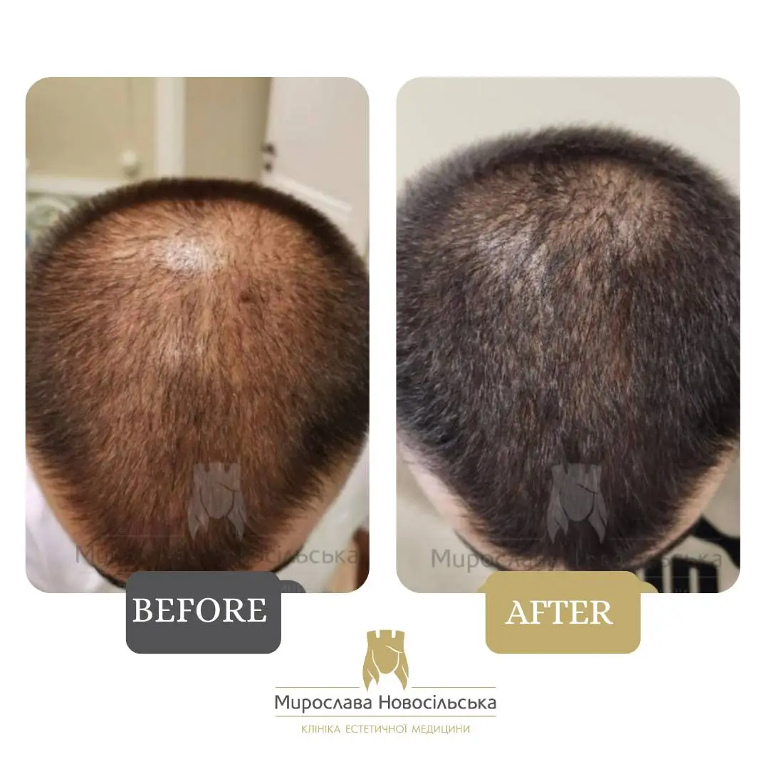 Hair procedures, photo 7