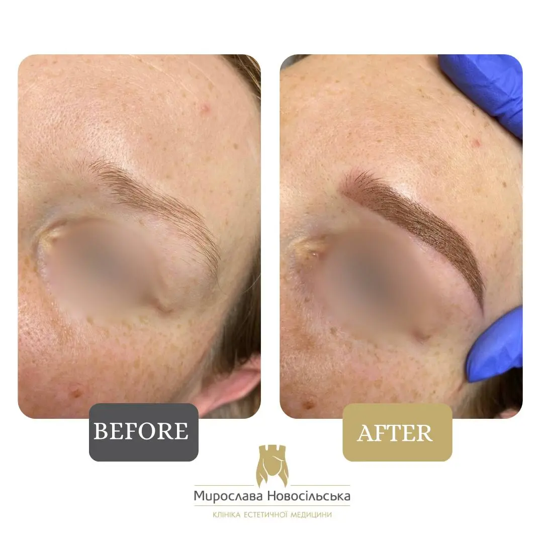Permanent eyebrows, photo 5