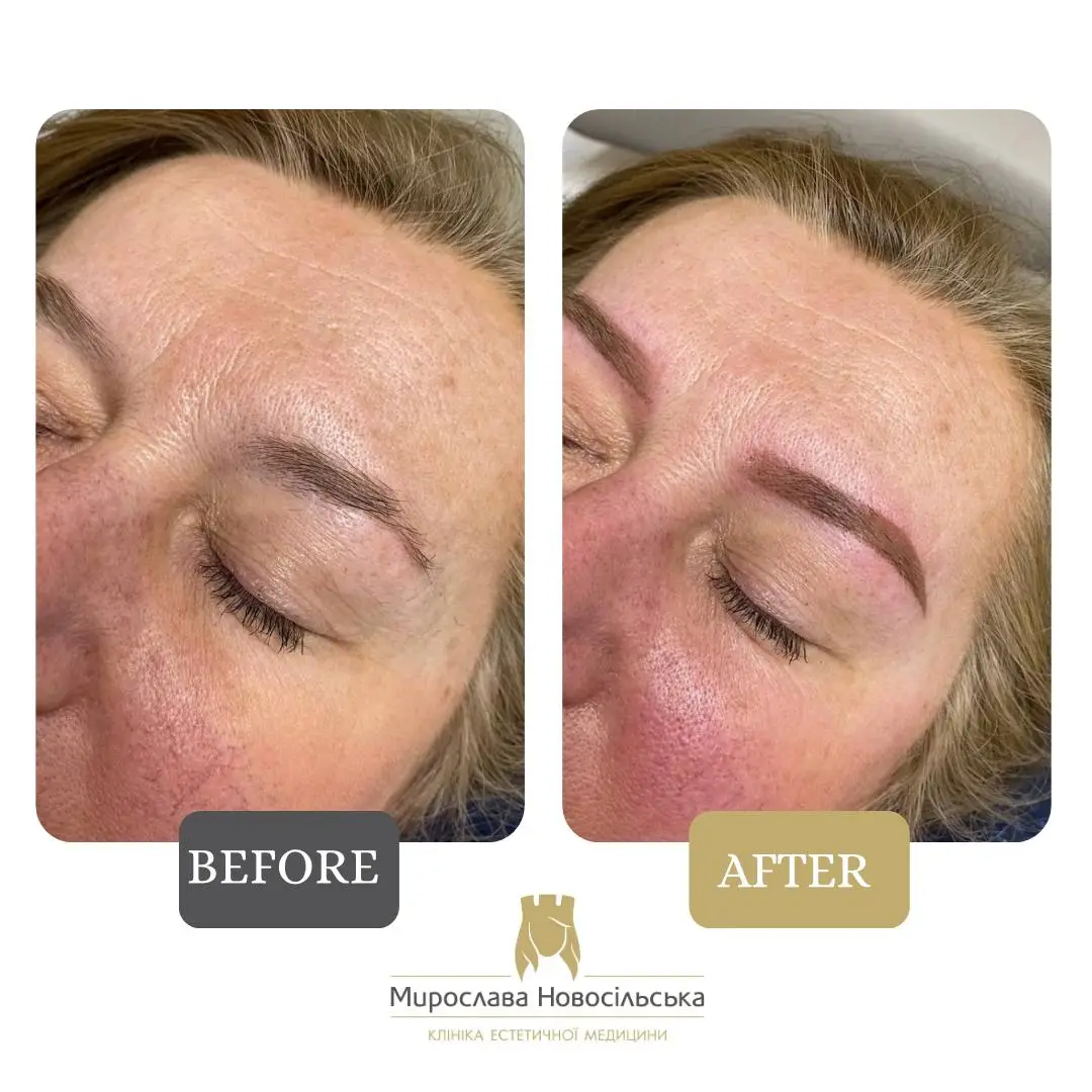 Permanent eyebrows, photo 4