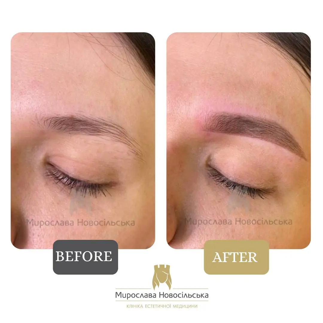 Permanent eyebrows