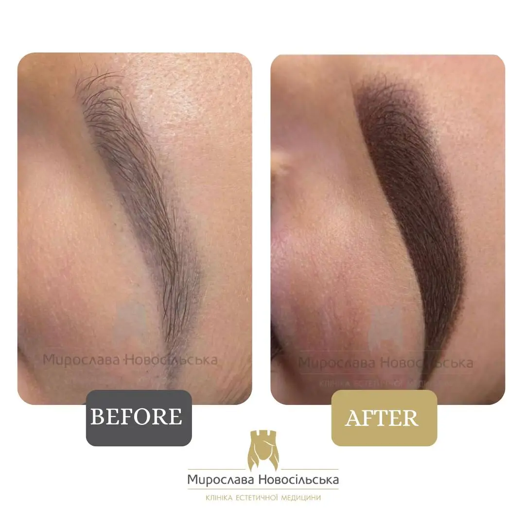 Permanent eyebrows