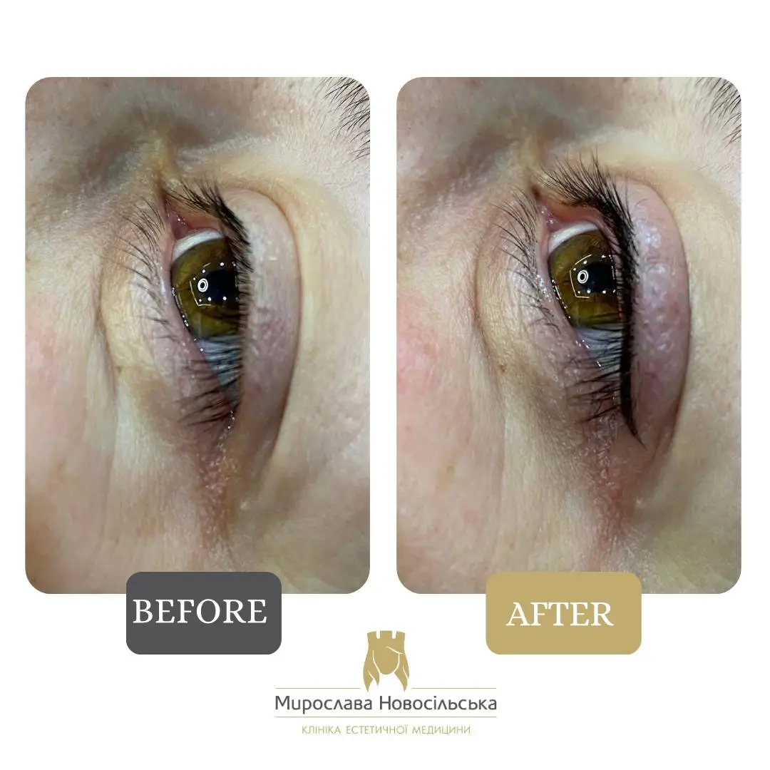 Eyeliner permanent makeup