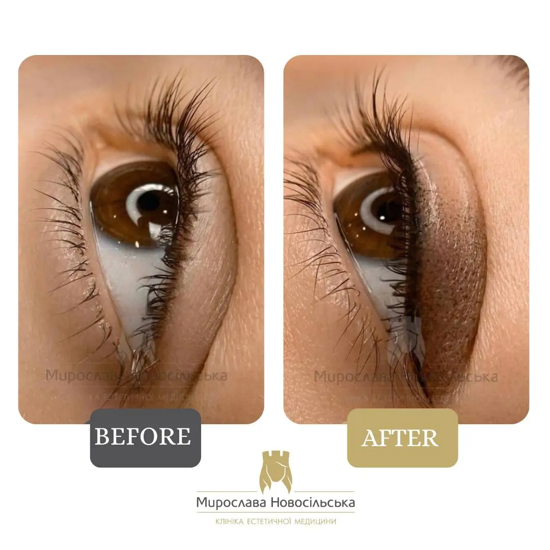 Eyeliner permanent makeup
