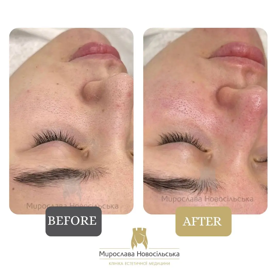 Ultrasonic cleansing, photo 3