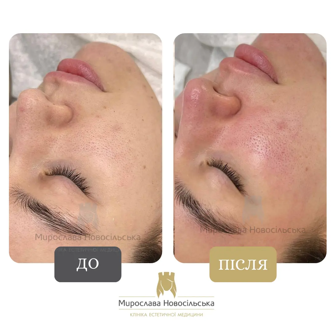 Ультразвукова чистка, фото 2