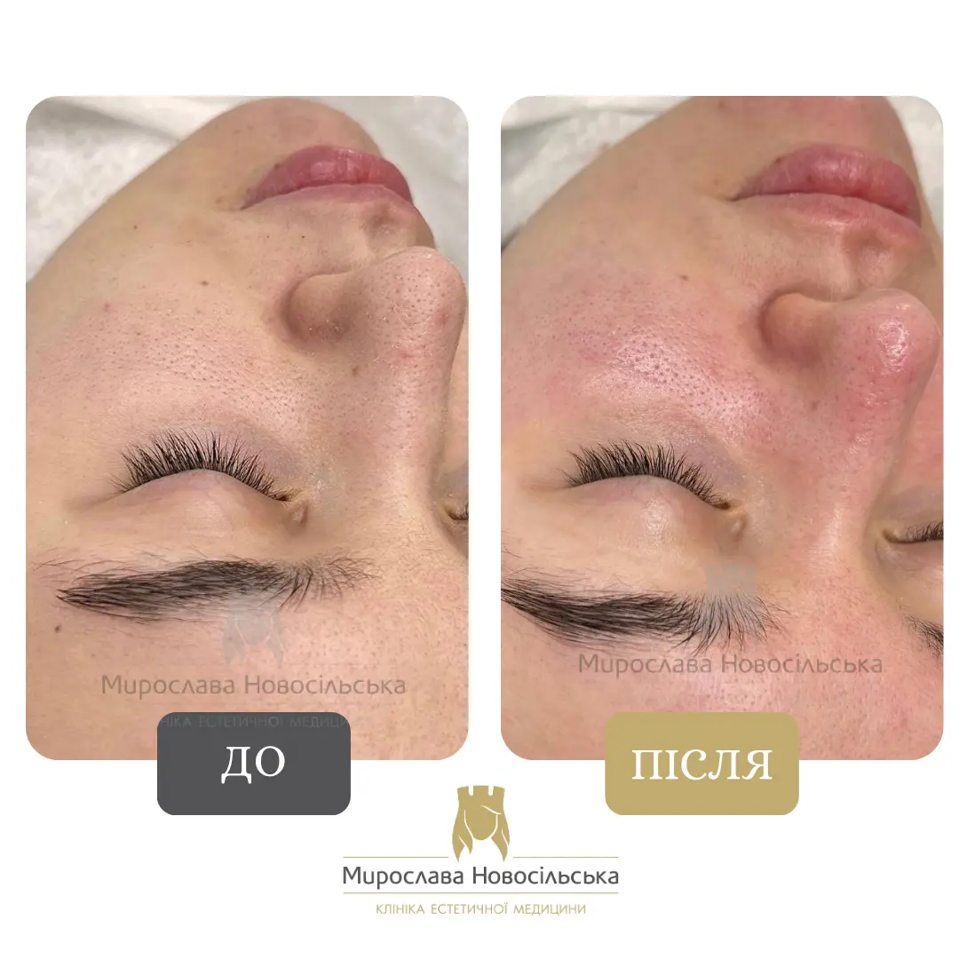 Ультразвукова чистка, фото 3