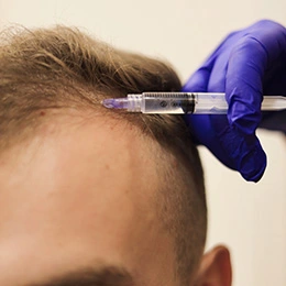 мезотерапія шкіри голови