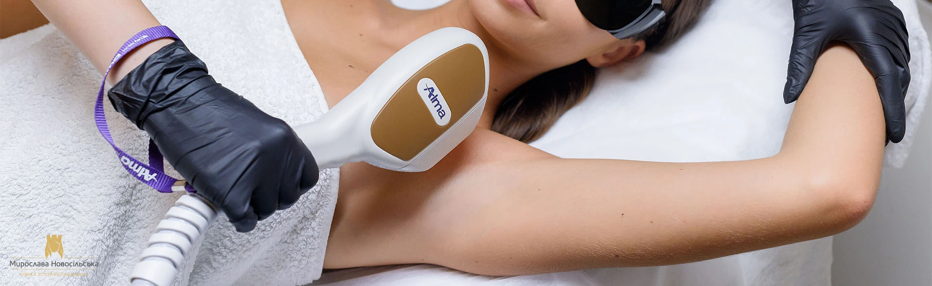 Laser epilation of armpits