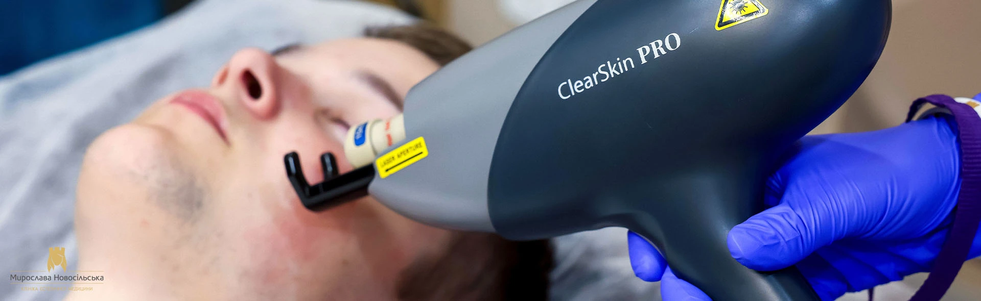 Лазерне лікування акне у Львові, фото 1