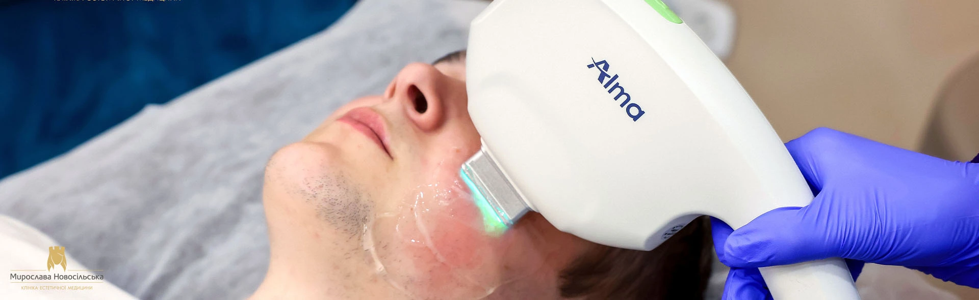 Laser removal of port-wine stains, photo 1