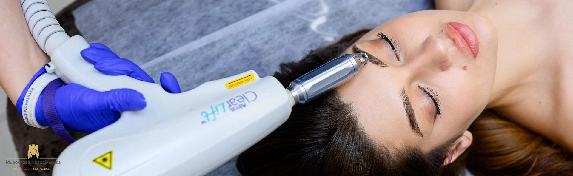 Laser removal of permanent makeup, photo 1