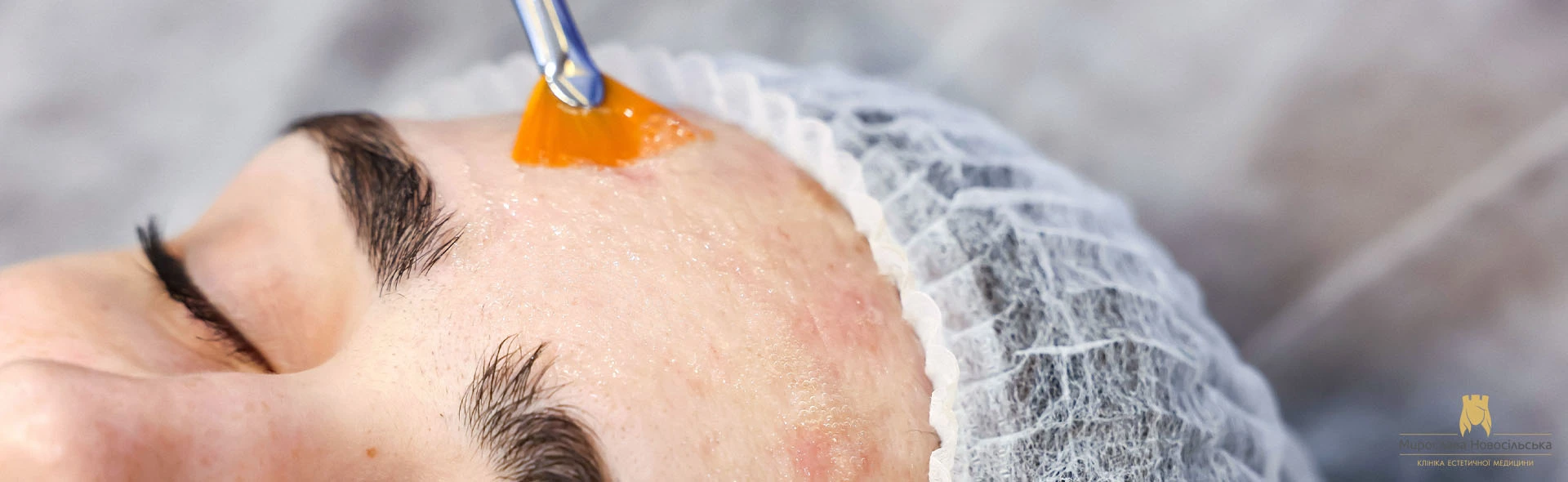 Carboxytherapy, photo 1