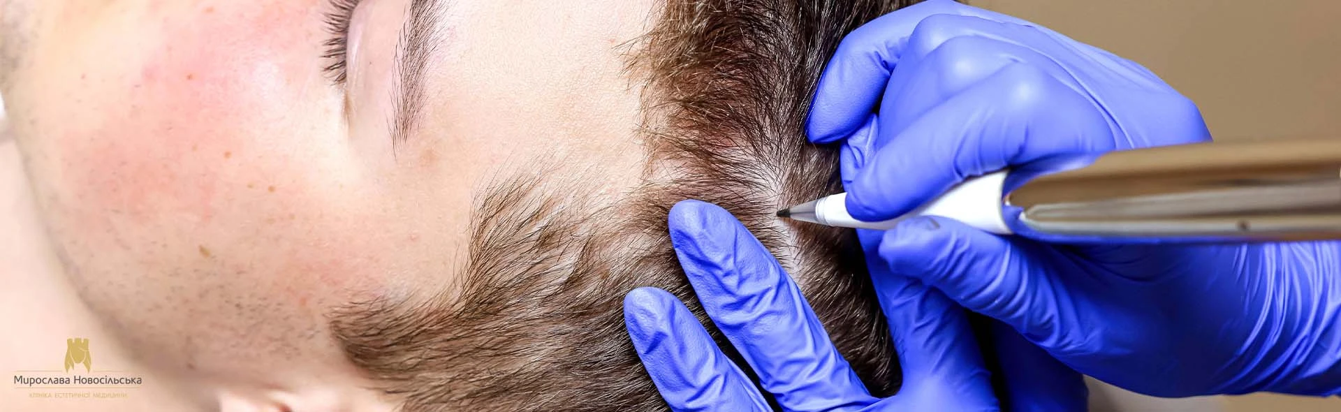 Trichopigmentation