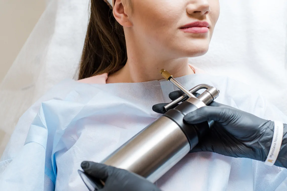 Laser removal of hemangiomas