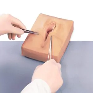 Labiaplasty in Lviv