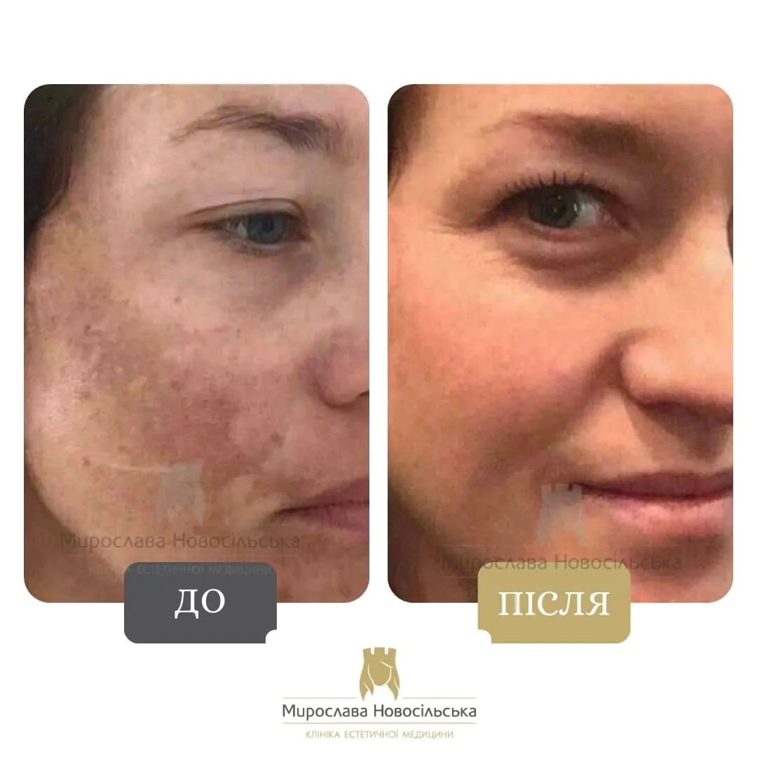 Dermatology in Lviv