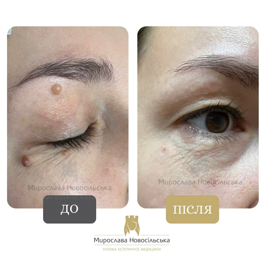 Dermatology in Lviv