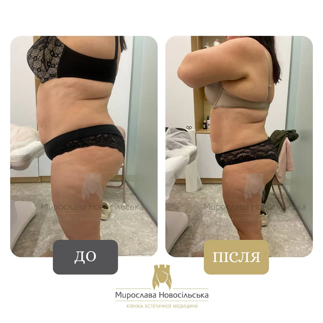 Massage for weight loss
